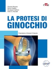 La protesi di ginocchio