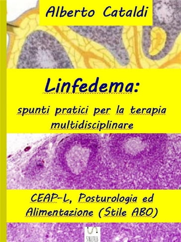 Linfedema - Alberto Cataldi