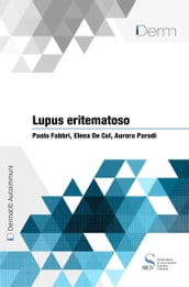 Lupus eritematoso