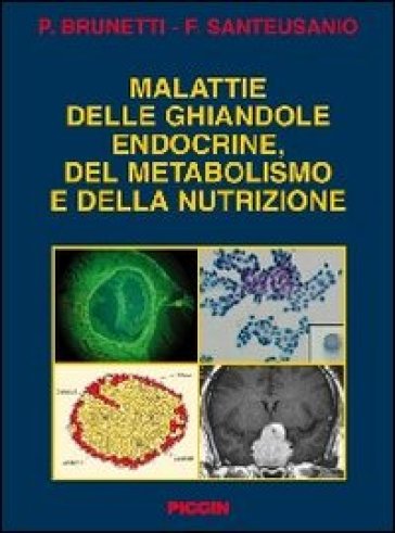 Malattie delle ghiandole endocrine del metabolismo e della nutrizione - F. Santeusanio - P. Brunetti