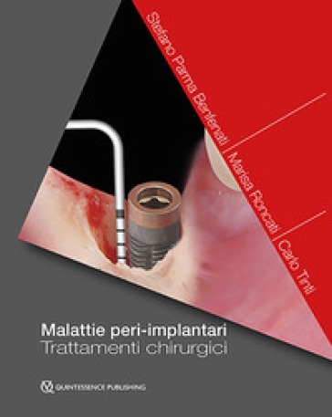 Malattie peri-implantari. Trattamenti chirurgici - Stefano Parma Benfanti - Marisa Roncati - Carlo Tinti