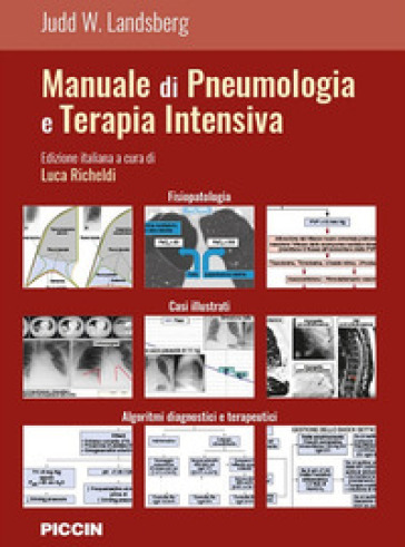 Manuale di pneumologia e terapia intensiva - Judd W. Landsberg