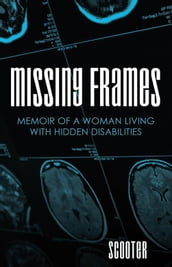 Missing Frames