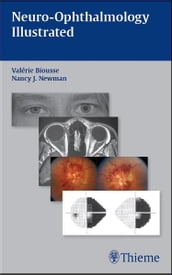 Neuro-Ophthalmology Illustrated