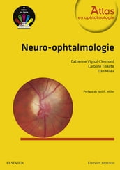 Neuro-ophtalmologie