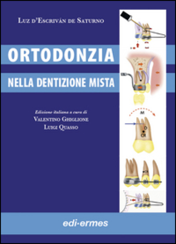 Ortodonzia nella dentizione mista - Luz D