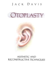 Otoplasty