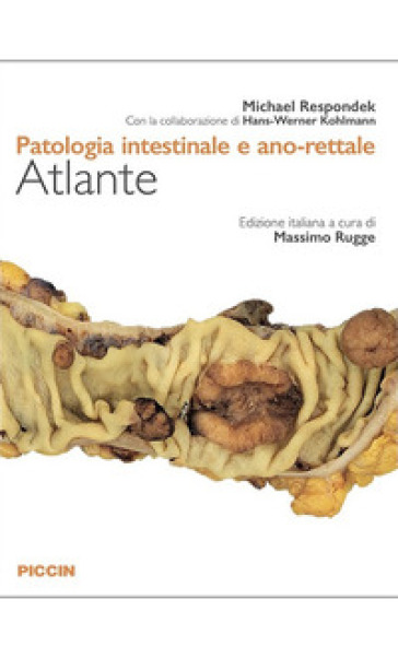 Patologia intestinale e ano-rettale. Atlante - Michael Respondek - Hans-Werner Kohlmann
