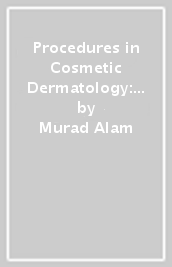 Procedures in Cosmetic Dermatology: Hair Restoration