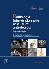 Radiologie Interventionnelle osseuse et anti-douleur