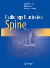 Radiology Illustrated: Spine