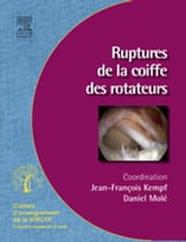 Ruptures de la coiffe des rotateurs