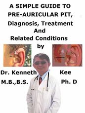 A Simple Guide to Pre-auricular Pit, Diagnosis, Treatment and Related Conditions