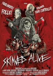 Skinned Alive