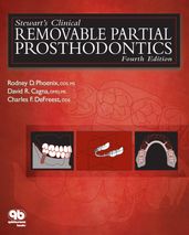 Stewart s Clinical Removable Partial Prosthodontics
