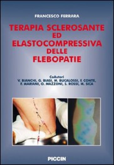 Terapia sclerosante ed elastocompressiva delle flebopatie - Francesco Ferrara