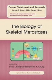 The Biology of Skeletal Metastases