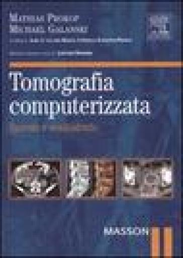 Tomografia computerizzata. Spirale e multistrato - Mathias Prokop - Michael Galanski