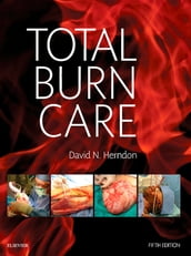 Total Burn Care E-Book