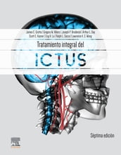 Tratamiento integral del ictus