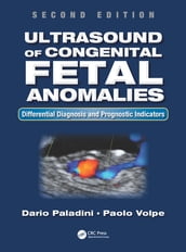 Ultrasound of Congenital Fetal Anomalies