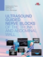 Ultrasoundguided nerve blocks of the trunk and abdominal wall