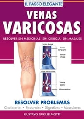 Venas Varicosas - Solución definitiva