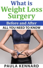 What Is Weight Loss Surgery: All You Need To Know Before And After
