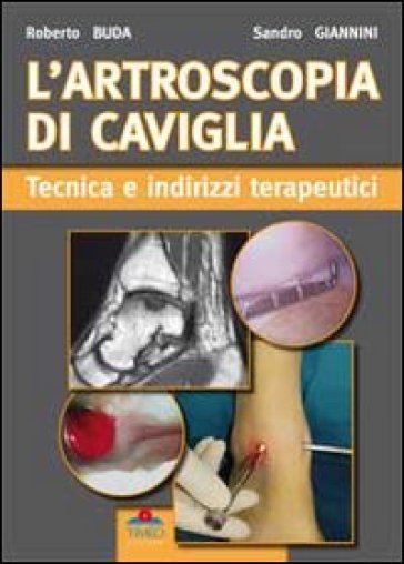 L'artroscopia di caviglia. Tecnica e indirizzi terapeutici - Sandro Giannini - Roberto Buda