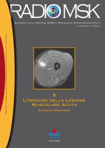 L'imaging della lesione muscolare acuta - Eugenio Genovese