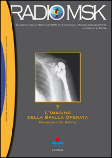 L'imaging della spalla operata. MSK. 7. - Francesco Di Pietto