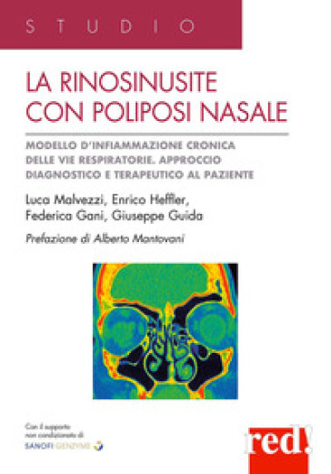 La rinosinusite con poliposi nasale. Modello d'infiammazione cronica delle vie respiratorie. Approccio terapeutico al paziente - Luca Malvezzi - Enrico Heffler - Federica Gani - Giuseppe Guida