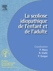 La scoliose idiopathique de l enfant et de l adulte