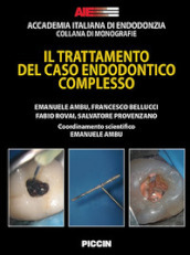 Il trattamento del caso endodontico complesso